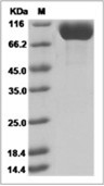 DPP4/CD26 Protein, Human, Recombinant (His)