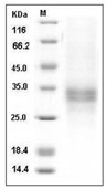 TNFR1/CD120a/TNFRSF1A Protein, Human, Recombinant (His)