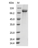 Transferrin Receptor/TFRC Protein, Mouse, Recombinant (His)
