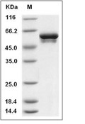 Vimentin Protein, Human, Recombinant (His)