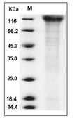 CD96 Protein, Human, Recombinant (His)