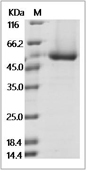 Dengue virus (DENV)(type 3, strain Philippines/H87/1956) E/Envelope Protein (aa 247-675, His)