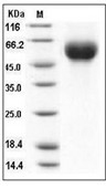 Influenza A H1N1 (A/California/04/2009) Hemagglutinin/HA1 Protein(His)