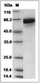 Transferrin Protein, Mouse, Recombinant (His)