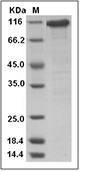 Beta-Catenin Protein, Human, Recombinant (His & GST)