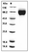 IL-18R alpha Protein, Mouse, Recombinant (His)