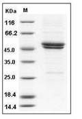 IL-11R alpha/IL-11RA Protein, Mouse, Recombinant (His)