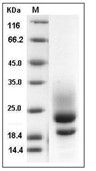 CD83 Protein, Human, Recombinant (His)