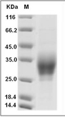 CD28H/TMIGD2 Protein, Human, Recombinant (His & Avi), Biotinylated