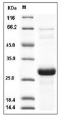 SNAP-25 Protein, Human, Recombinant (His)