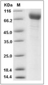 TEM8/ANTXR1 Protein, Human, Recombinant (hFc)