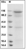 DPP4/CD26 Protein, Human, Recombinant