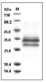 IL-25/IL17E Protein, Mouse, Recombinant (His)