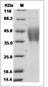 IL-21R Protein, Mouse, Recombinant (His)