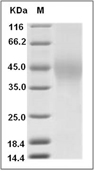 TIM-3/KIM-3/HAVCR2 Protein, Human, Recombinant (His), Biotinylated