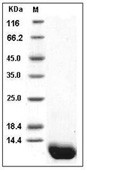 Complement C5 Protein, Human, Recombinant (Complement C5a)