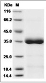ANGPTL4 Protein, Human, Recombinant (His)