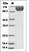 FGFR2 Protein, Mouse, Recombinant (hFc)