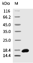 FGF-2 Protein, Human, Recombinant
