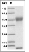 FCGRT & B2M Heterodimer Protein, Rat, Recombinant (His)