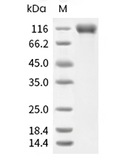 Siglec-2/CD22 Protein, Human, Recombinant (His)