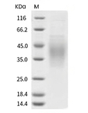 IL-18BP Protein, Human, Recombinant (His)