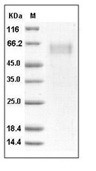 ST2/IL-1 RL1 Protein, Human, Recombinant