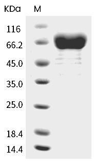 IL-21R Protein, Human, Recombinant (hFc)