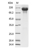 HER3/ERBB3 Protein, Human, Recombinant (His)