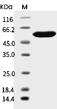 Influenza A H3N2 (A/Hong Kong/45/2019) Nucleoprotein/NP Protein (His)