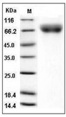 VNN1 Protein, Human, Recombinant (His)