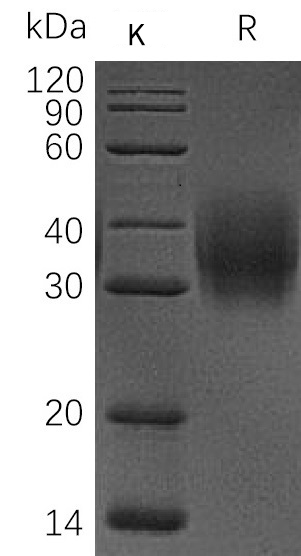 CD47 Protein, Human, Recombinant (His)