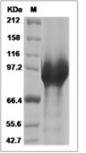 ENPP2 Protein, Cynomolgus, Recombinant (His)