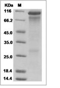 HER3/ERBB3 Protein, Human, Recombinant