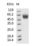 IL-18R alpha Protein, Human, Recombinant (His)