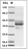 EpCAM/TROP1 Protein, Human, Recombinant (His & Avi), Biotinylated