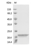 BAFF/TNFSF13B Protein, Human, Recombinant (HEK293)