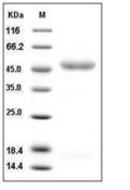 IL-11R alpha/IL-11RA Protein, Human, Recombinant (His)