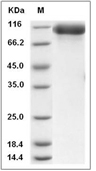 HER3/ERBB3 Protein, Rat, Recombinant (His)