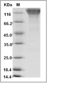 CD45 Protein, Human, Recombinant (aa 1-529, His)