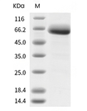 CD122/IL2RB Protein, Human, Recombinant (mFc)