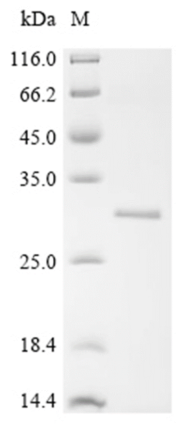 S100A9 Protein, Rat, Recombinant (His & SUMO)