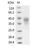 CD25/IL2R alpha Protein, Cynomolgus, Recombinant (His)