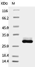 Apolipoprotein A-I/APOA1 Protein, Mouse, Recombinant (His)