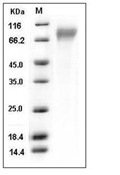 CD30/TNFRSF8 Protein, Human, Recombinant (His)