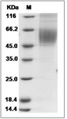 CDCP1 Protein, Human, Recombinant (His)