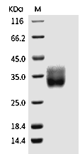 HER2/ERBB2 Protein, Human, Recombinant (aa 1-195, His)