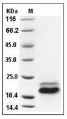 DR5/TRAIL R2 Protein, Human, Recombinant (His)