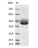 IL-12B Protein, Human, Recombinant (His)