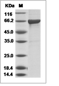 Influenza B (B/Florida/4/2006) Nucleoprotein/NP Protein (His)